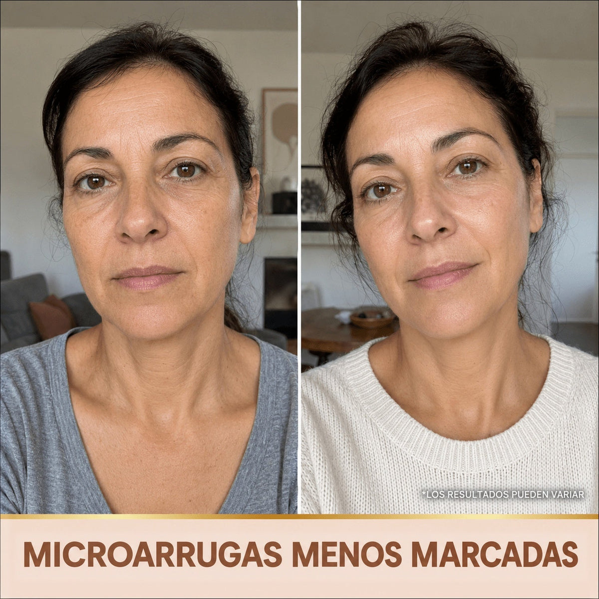 Microarrugas menos marcadas