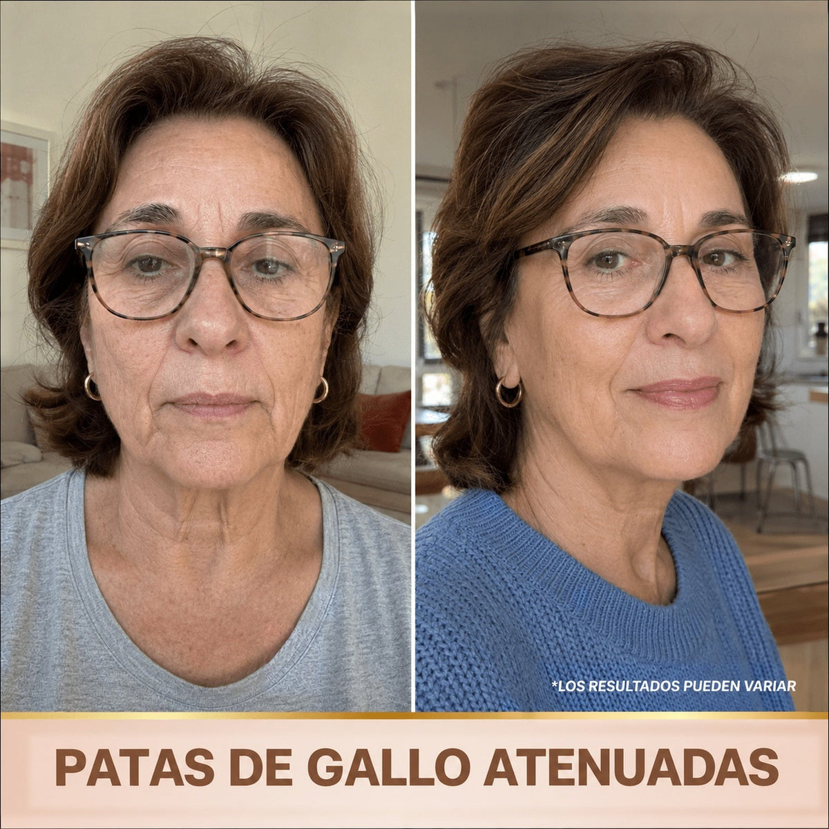 Patas de gallo atenuadas