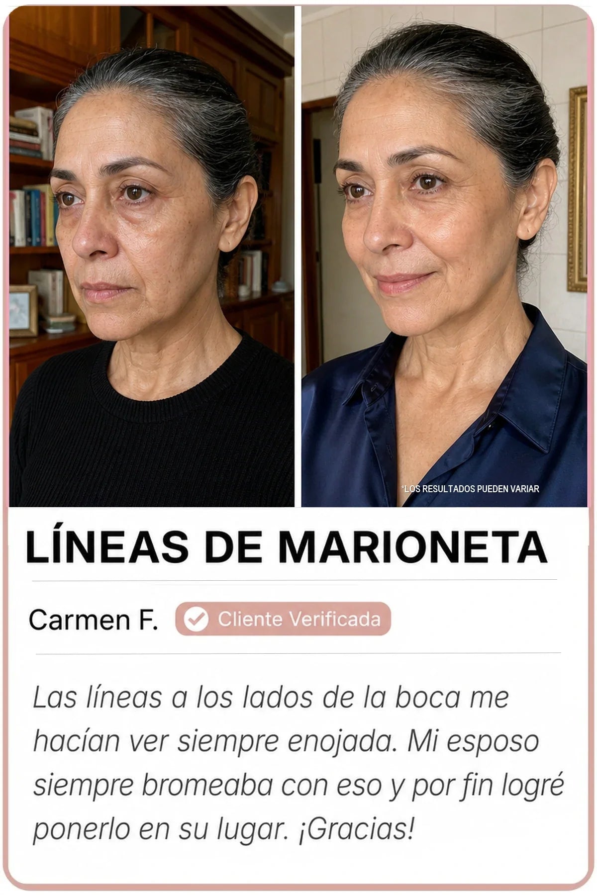 Antes y después Sedanza — Líneas de marioneta, Carmen F.
