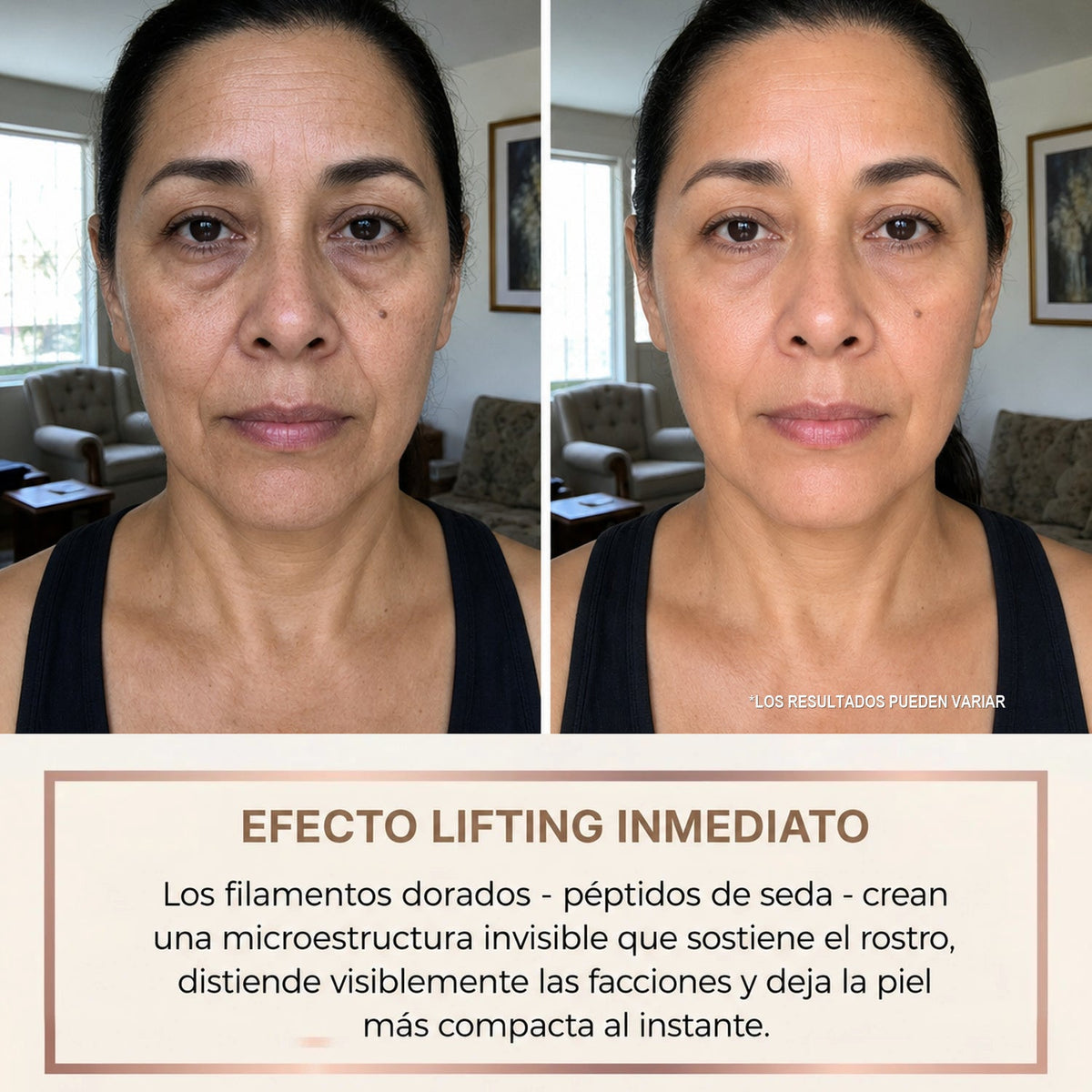 Efecto lifting inmediato - antes y despues