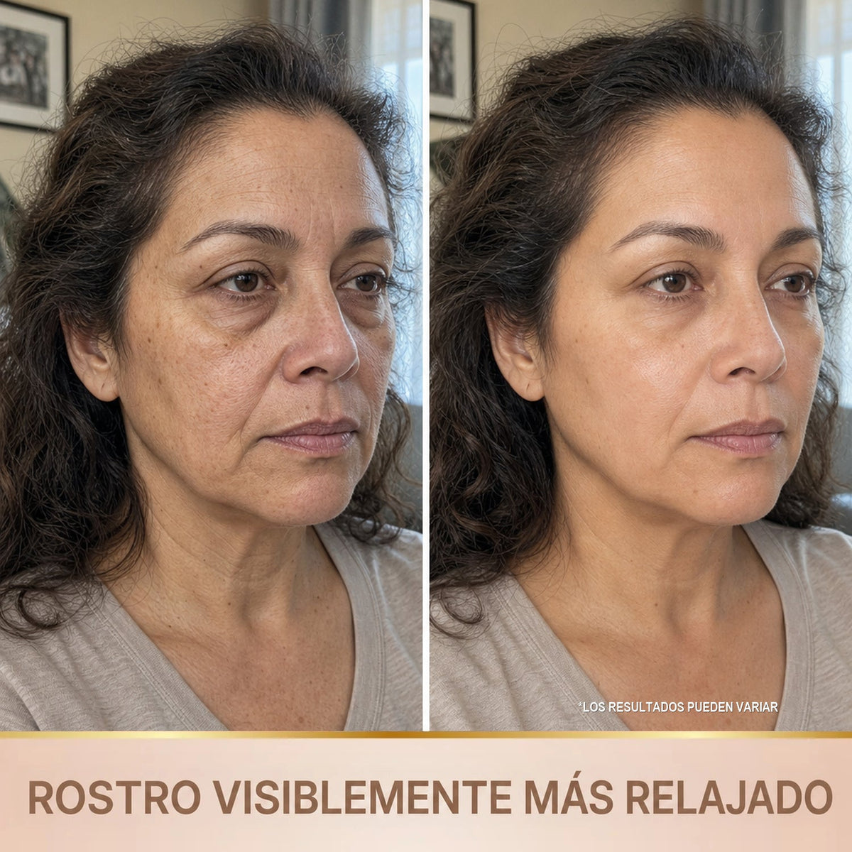 Rostro visiblemente mas relajado - antes y despues