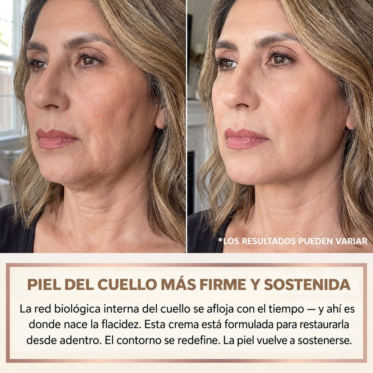 Piel del cuello más firme y sostenida