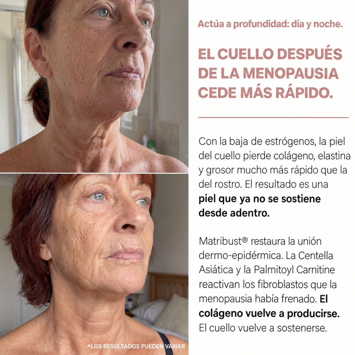 El cuello después de la menopausia