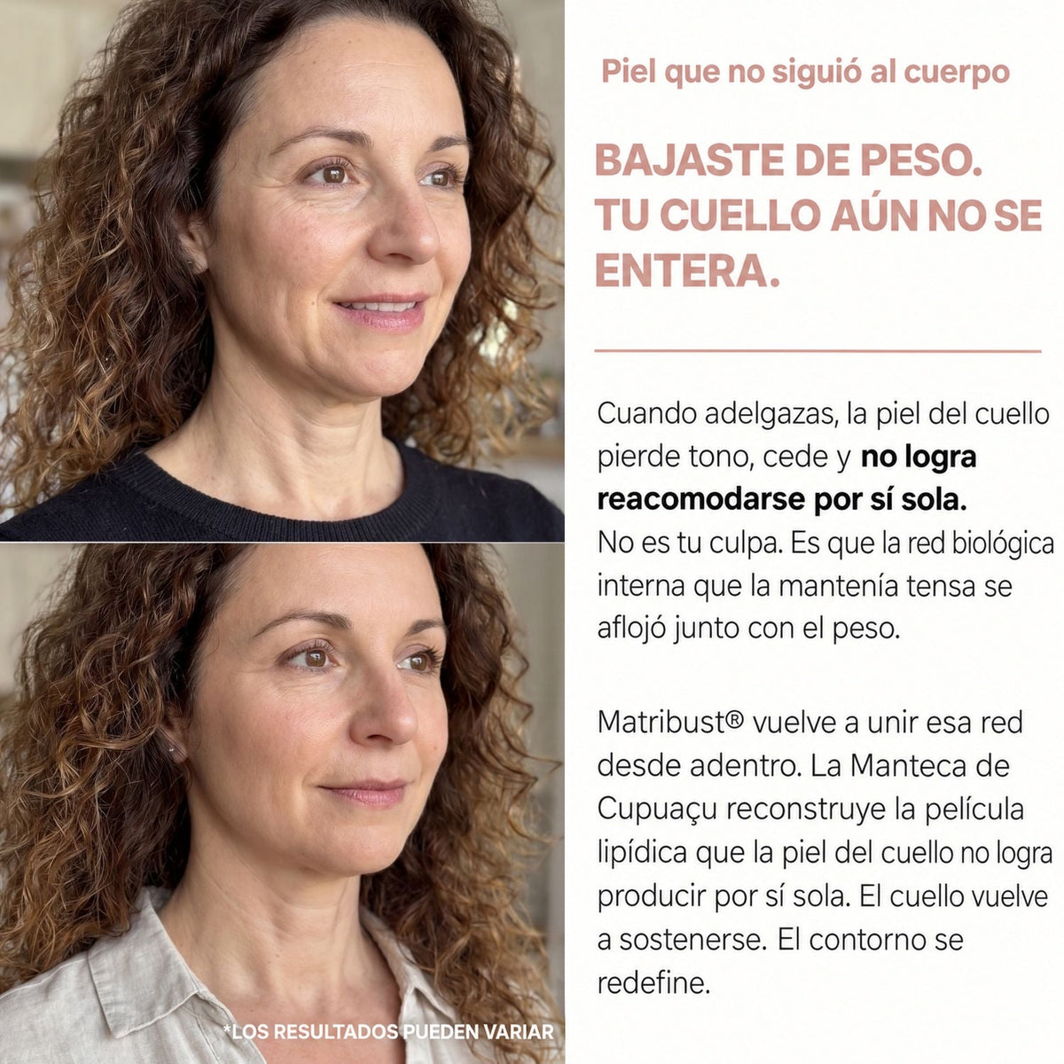Bajaste de peso, tu cuello aún no se entera